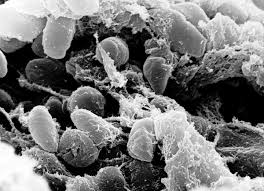 Yersinia pestis - Wikipedia